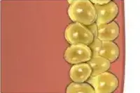 360°c cryolipolysis slimming system