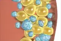 360°c cryolipolysis slimming system