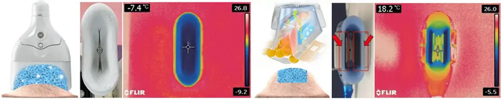 cryolipolysis slimming device 360°c cooling tech