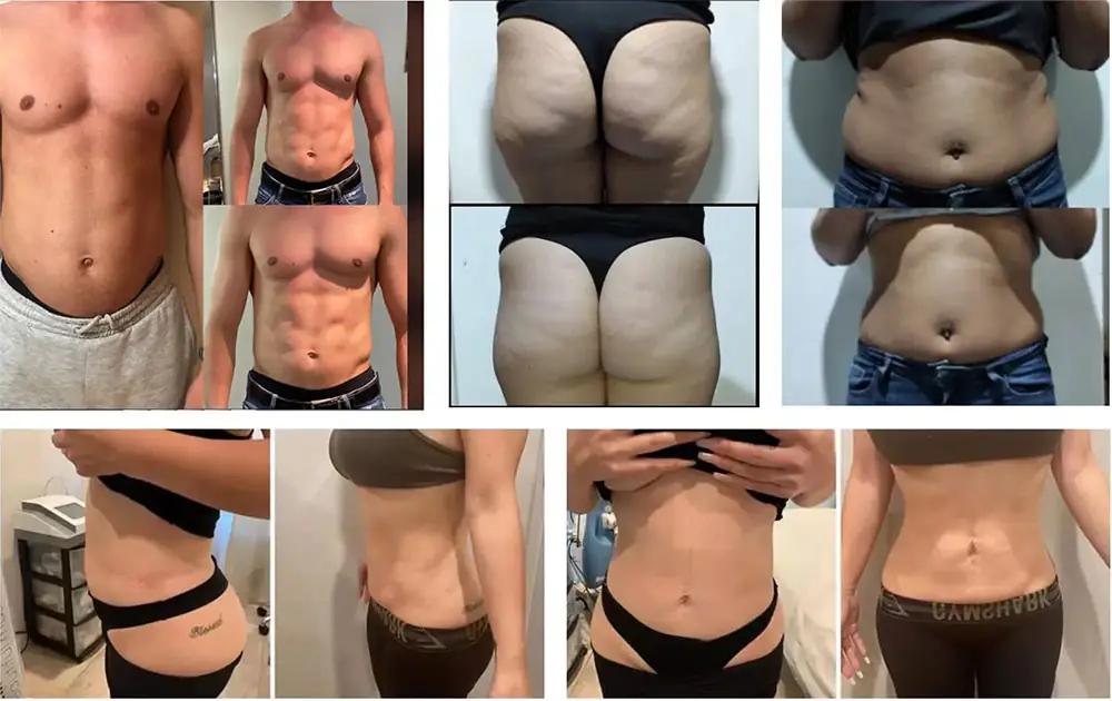 hiemt emsculpting muscle building machine