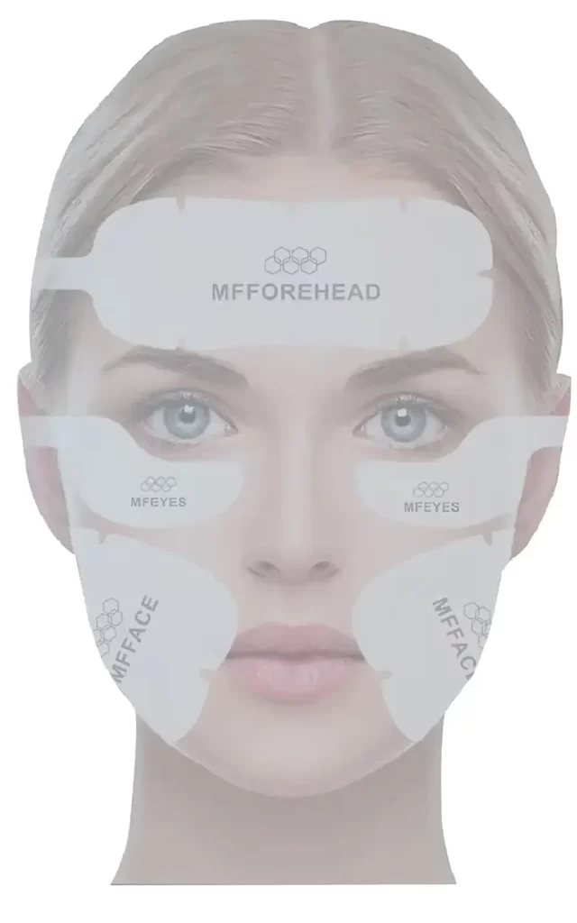 hilfes (high intensity low frequency electrical stimulation) + emt magnetic stimulation + precision