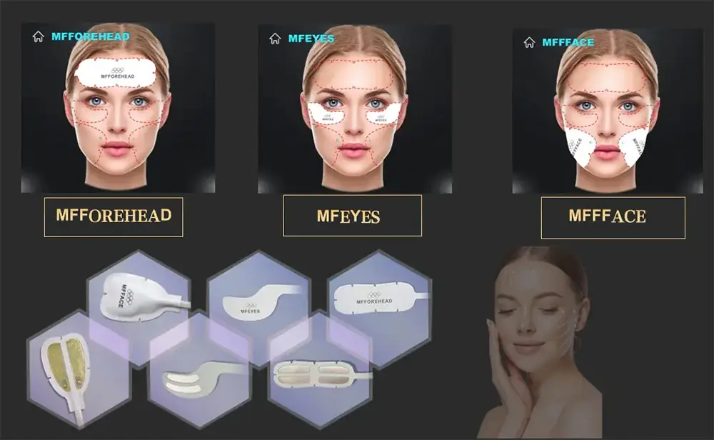 hilfes (high intensity low frequency electrical stimulation) + emt magnetic stimulation + precision