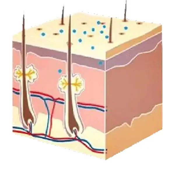 hydra microdermabrasion system