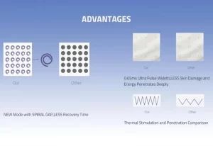 Introducing the Homi Beauty Advanced Portable CO2 Fractional Laser~~