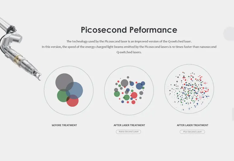 Introducing the revolutionary Picosecond Laser Tattoo Removal Machine