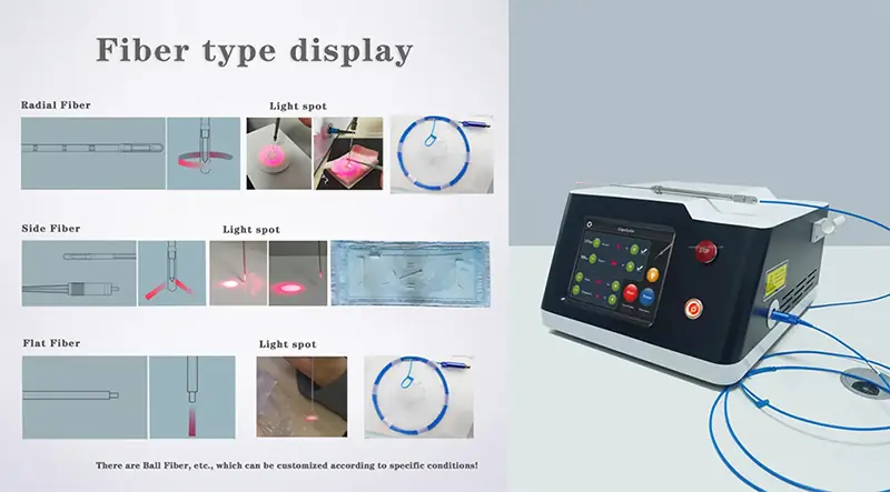 Introduction-of-the-1470nm-diode-laser-for-liposuction-a-revolutionary-leap-in-aesthetic-medicine-1