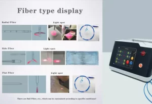 Introduction of the 1470nm diode laser for liposuction: a revolutionary leap in aesthetic medicine