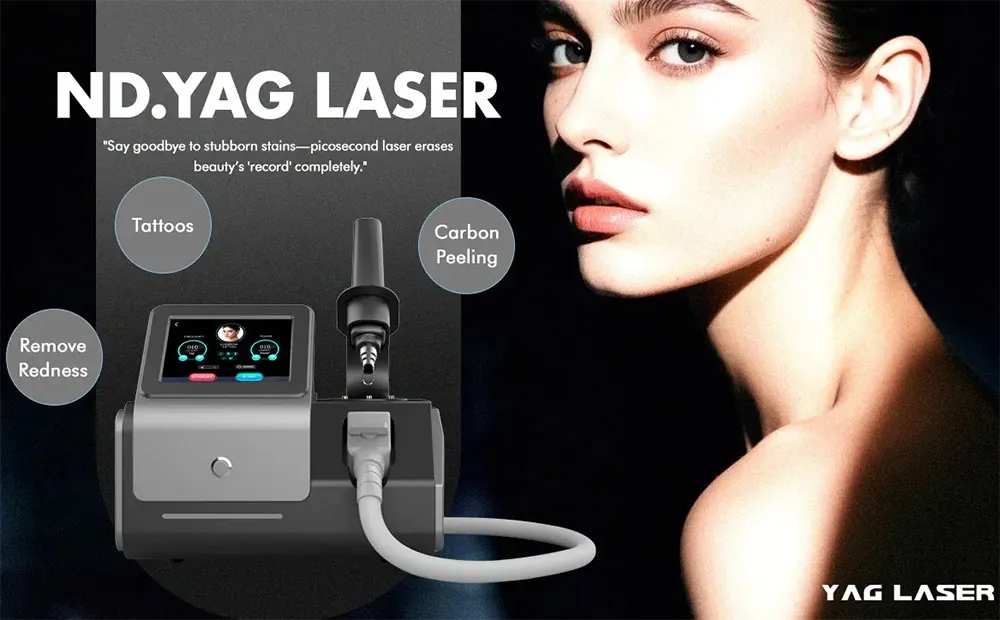 nd yag laser z