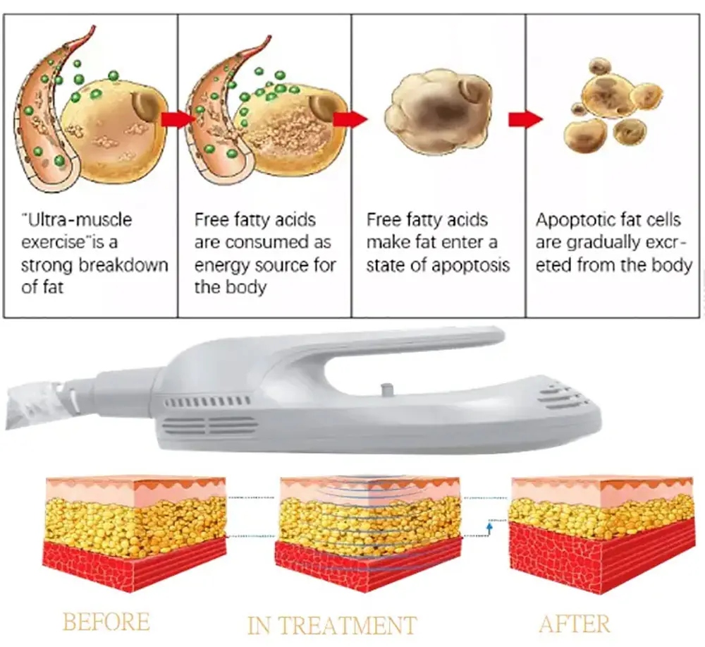 portable hiemt emsculpting muscle building machine