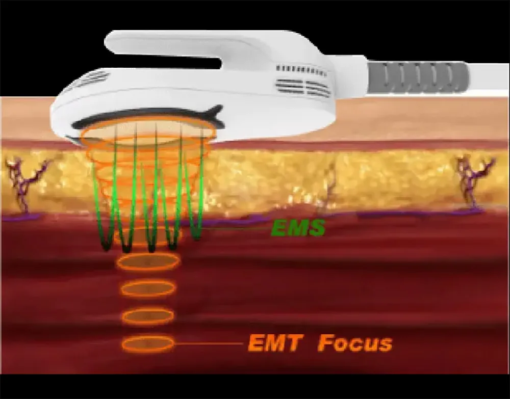 portable hiemt emsculpting muscle building machine
