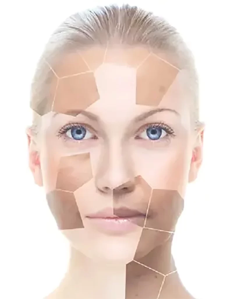 q switched nd yag laser device