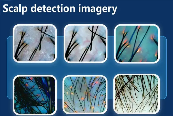 ai skin image analyzer for professional clinics & spas