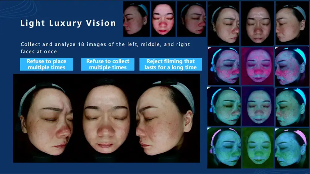 Skin-Analyzer-1-Light-Luxury-Vision