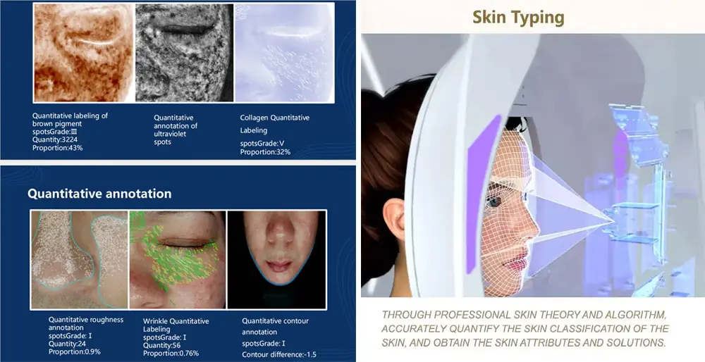 Skin-Analyzer-1-Skin-Typing