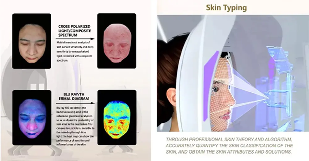 skin analyzer