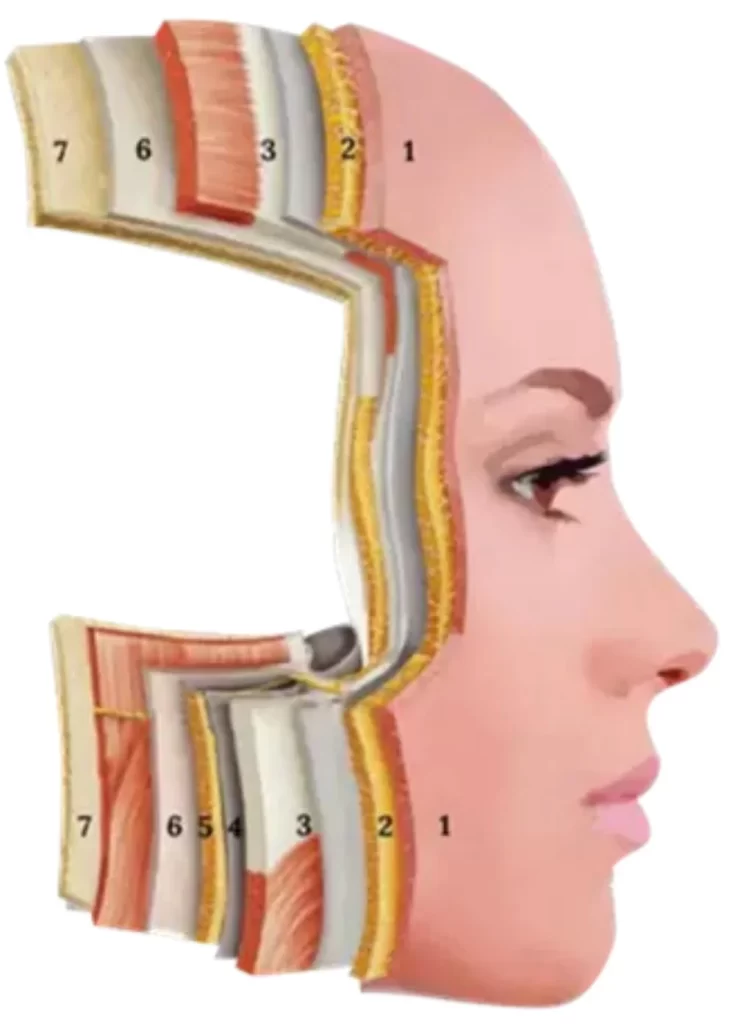 high energy focused ultrasound +focus rf 3d lifting