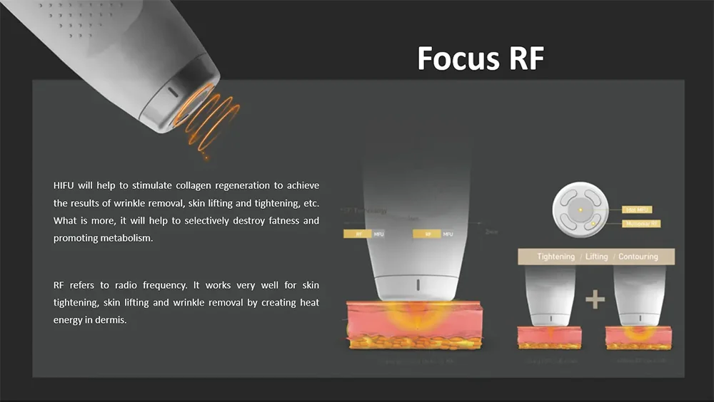 high energy focused ultrasound +focus rf 3d lifting