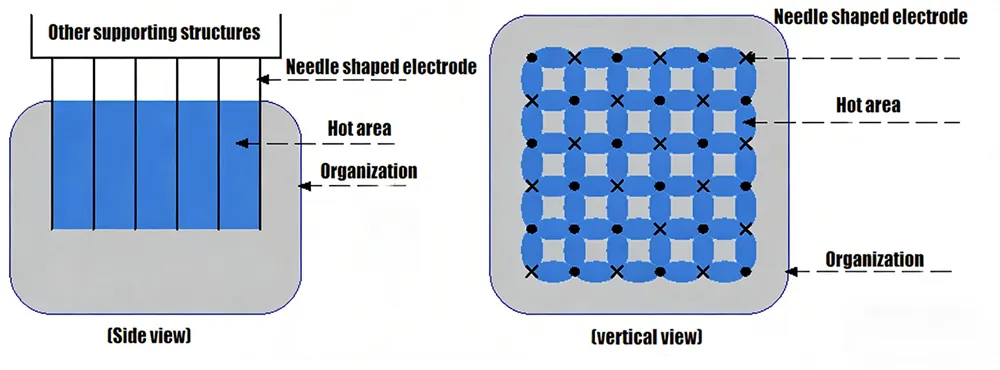 hm mf 01 golden microneedling rf & fractional rf machine
