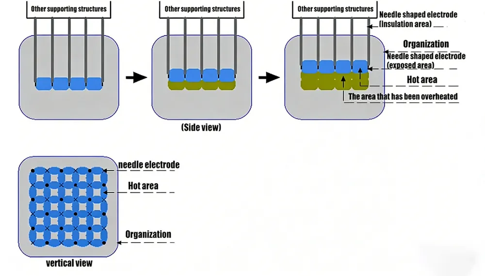 hm mf 01 golden microneedling rf & fractional rf machine