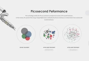How to Choose Q-Switched ND:YAG Laser Manufacturer (2026 Ultimate Guide)