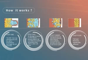 Can a 360° Cryolipolysis Machine Revolutionize Non-Invasive Body Contouring?
