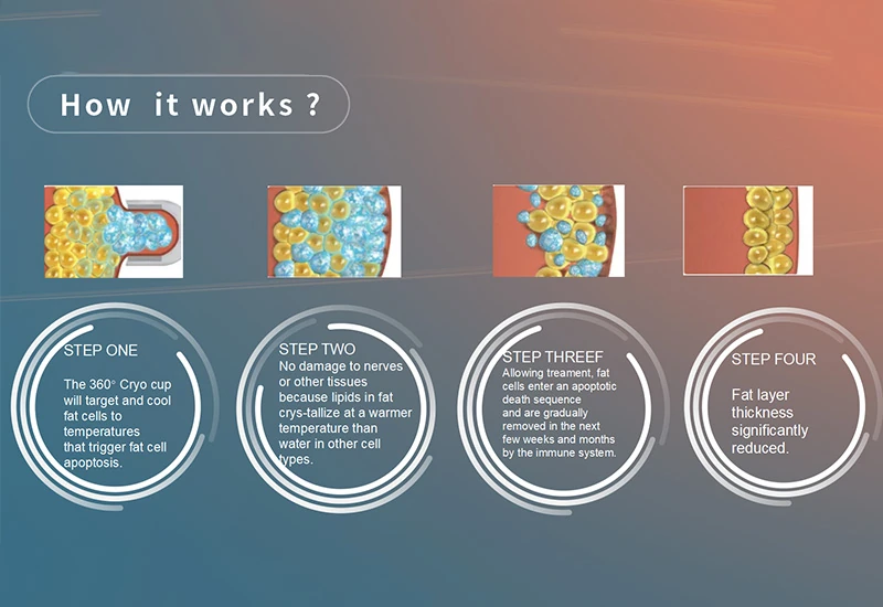 Can a 360° Cryolipolysis Machine Revolutionize Non-Invasive Body Contouring?