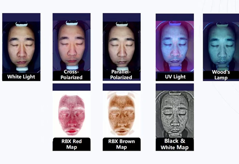 Why Is AI Skin Image Analyzer a Must-Have Device for Modern Clinics & Spas?
