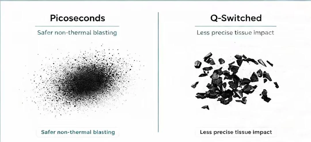 picosecond vs q switched laser pigment fragmentation comparison